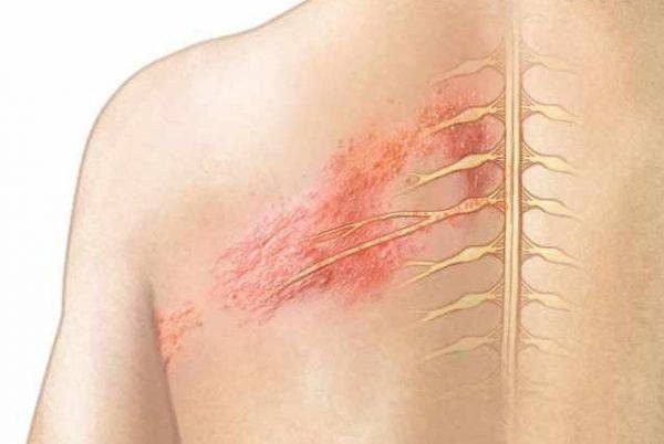 Công dụng của kem 7 màu là gì ? Thuốc 7 màu có trị mụn được không ? 6 Công dụng của kem 7 màu là gì ? Thuốc 7 màu có trị mụn được không ?