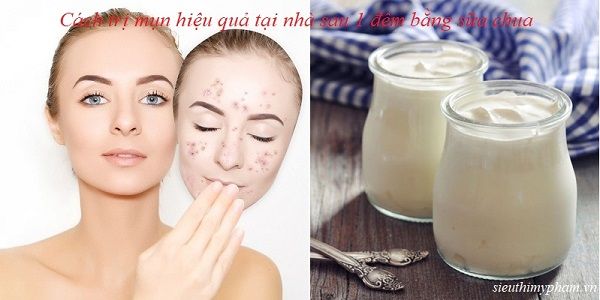 Top 10 cách trị mụn tại nhà đơn giản, dễ thực hiện sau 1 đêm Top 10 cách trị mụn tại nhà đơn giản, dễ thực hiện sau 1 đêm